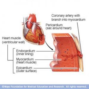 המיוקרדיום (myocardium) הוא השכבה האמצעית והעבה של שריר הלב. חלק זה של שריר הלב אחראי לרוב כח השאיבה של הלב. חלק זה של הלב חלש באנשים הסובלים ממחלת שריר הלב (cardiomyopathy) . © Mayo Foundation